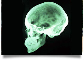 Oklahoma Traumatic Brain Injury Attorneys